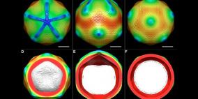 فيروس عملاق قد يكون سبب الإصابة بالتهاب المفاصل