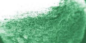 "اسفنجة ذكية" لعلاج السكري