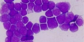 تغيير التعبير الجينى فى جين واحد يطيل العمر بنسبة 20%