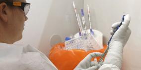 روسيا... رسميا تسجيل مواد كاشفة لفيروس "ايبولا"