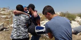 الاحتلال يقمع مسيرات الجمعة ويصيب عددا من المشاركين