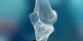 تفصيل أعضاء اصطناعية بالطباعة المجسمة