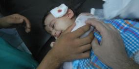 شمال غزة: مستشفى كمال عدوان يستقبل عشرات الجرحى