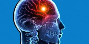 كيفية الوقاية من الجلطات الدماغية