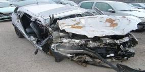 بتر قدميّ أمريكية بعد أسبوع انتظار في سيارة دون طعام وشراب