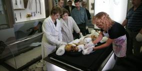 دراسة: الأمراض السرطانية كانت تصيب الإنسان القديم ايضا