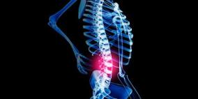 البروسيلا"يسبب الحمى الملطية والتهابات مزمنة بالعظام والعمود الفقري