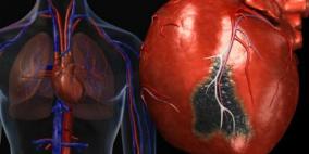 الشخص الجميل أقل عرضة للأمراض