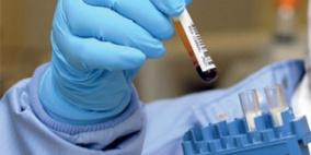 دراسة: بروتين (PLAC8) يساعد على انتشار سرطان القولون