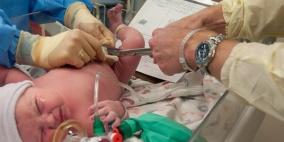 تأخير قص الحبل السري يسمح بتدفق مزيد من الدم للمولود