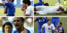 بالصـور: تكنولوجيا خط العضة .. اختراع جديد من أجل سواريز