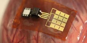 الاعضاء المزروعة تواصل العمل ما دام الشخص على قيد الحياة