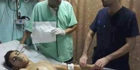 استشهاد شاب من مخيم جنين متأثرا بجراحه