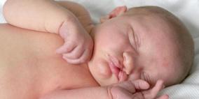 20 ألف مولود فرنسي ولدوا بعيب خلقي وراثي منذ 2011