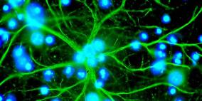 علماء من جامعة تكساس يتمكنون توليد خلايا عصبية من خلايا مساعدة