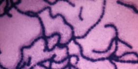 الكتب واللعب وأسرة الأطفال تتحول إلى منازل للجراثيم لمدة طويلة