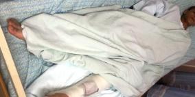 "المقاصد" يستقبل 147 جريحاً ومصاباً وصفت حالة بعضهم بالحرجة