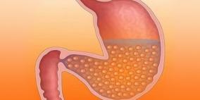 الكشف عن وسيلة جديدة ضد البدانة