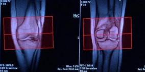 دراسة: الصيام يخفف من آلام المفاصل