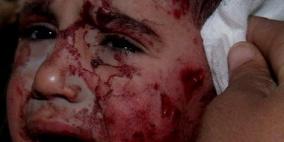 غزة: 18 شهيدا بين قصف وانتشال اليوم