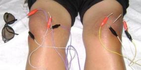 التحفيز الكهربائي.. أمل جديد للمصابين بشلل الركبتين