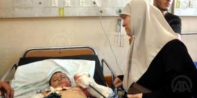 بلا قدم وأصابع.. الطفل "ثائر" يبكي أما و4 أشقاء