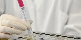 الفلبين تؤكد ثاني حالة إصابة بـ"كورونا"