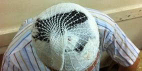 "محدث بالصور" تمديد اعتقال 5 مقدسيين بعد الاعتداء عليهم