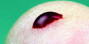 اختبار دم لرصد الفيروسات