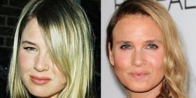 ما الذي حصل لكِ يا رينيه؟