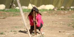 فريق طبي متخصص من وزارة الصحة يقيم يوم طبي في مضارب المالح في الغور إستجابة لدعوة شبكة راية الإعلامية وإذاعة راية أف أم   الألبوم الثاني