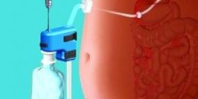 جهاز ينقص الوزن بكبسة زر