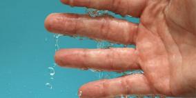 علاجات طبيعية لتعرّق اليدين المفرط