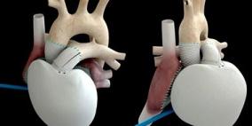 التدخين والسكر والضغط أكثر أسباب الإصابة بأمراض القلب