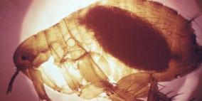 قلق من عودة بكتيريا بدأت في مصر وقتلت 100 مليون