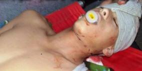 استشهاد فتى برصاص الاحتلال قرب رام الله