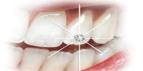 مرض السكر والكبد والحالة النفسية السيئة تؤدى إلى فقدان الأسنان