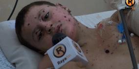 (فيديو وصور) ثائر = حرب غزة