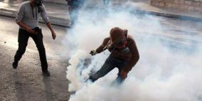 إصابة طفل بعيار اسفنجي في نعلين