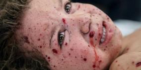 الدواء في زمن الحرب: الرصيد "تحت الصفر" في غزة