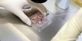 العلماء يعلنون عن إعداد أول مصل ضد فيروس كورونا