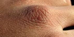 الاستخدام المفرط لمستحضرات التجميل قد يسبب "جفاف الجلد"