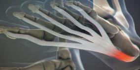 طرق معالجة آلام القدم ومسمار الكعب