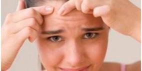 عامل جديد في ظهور حبّ الشباب!