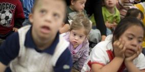 متلازمة "داون" ستكون قابلة للعلاج قريبا