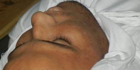 صور.. الشاب أنور الملوكي الشهيد الرابع في زمن التهدئة