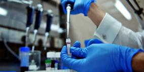 الصحة: لا داعي للهلع من انفلونزا "A"