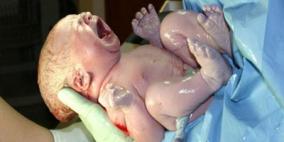 ولادة أول طفل في العالم برحم مزروع