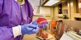 فيروس كورونا.. تقدم واعد في البحث عن علاج