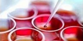 استخدام تحليل الدم "بروتين" CA125فى الاكتشاف المبكر لسرطان المبيض